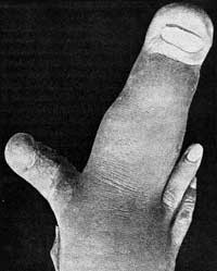 Freak Finger